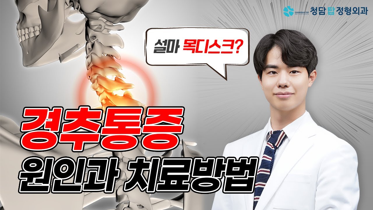[ep44.]경추통증의 원인과 증상 그리고 치료 방법까지 알려드립니다! - YouTube