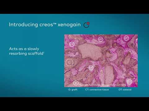 creos xenogain: The natural framework for bone formation