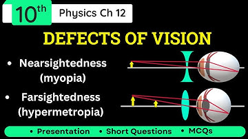 Defects of Vision Nearsightedness & Farsightedness Class 10 physics Ch 12 | myopia & hypermetropia