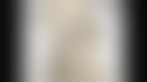 Tibiotalar Arthrodesis| lateral ankle arthodosis| Ankle arthrodesis| Ankle fusion