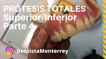 ¿Cuánto tiempo se debe llevar la dentadura postiza por primera vez?