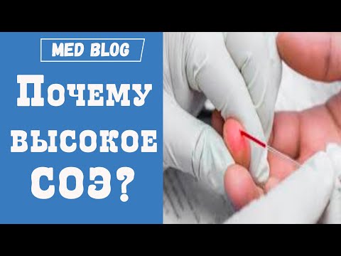 Video: Соя деген эмне?