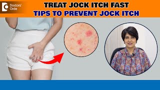 Jock Itch (Tinea Cruris)| Best ways to avoid Itching Down There - Dr. Rasya Dixit| Doctors' Circle