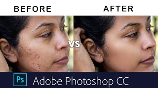 Easy spot remove and photo retouch in photoshop.