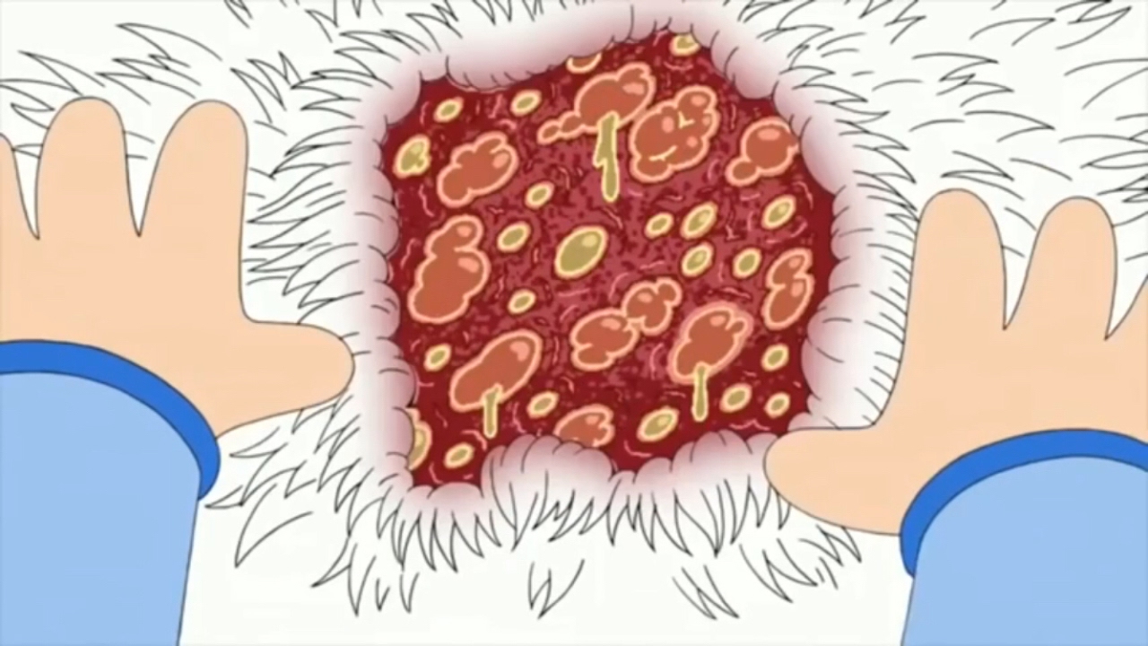 Family Guy Stewie gets Herpes YouTube