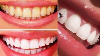 طبيب اسنان اهداني وصفات تبييض الاسنان وازاله الجير في المنزل نتائج مذهله