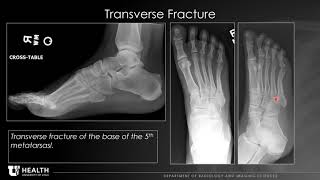 MSK trauma/fractures, Dr  Richard Leake