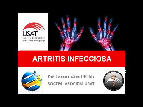 Vídeo: Artritis Infecciosa: Causas, Síntomas Y Tratamiento De La Artritis Infecciosa