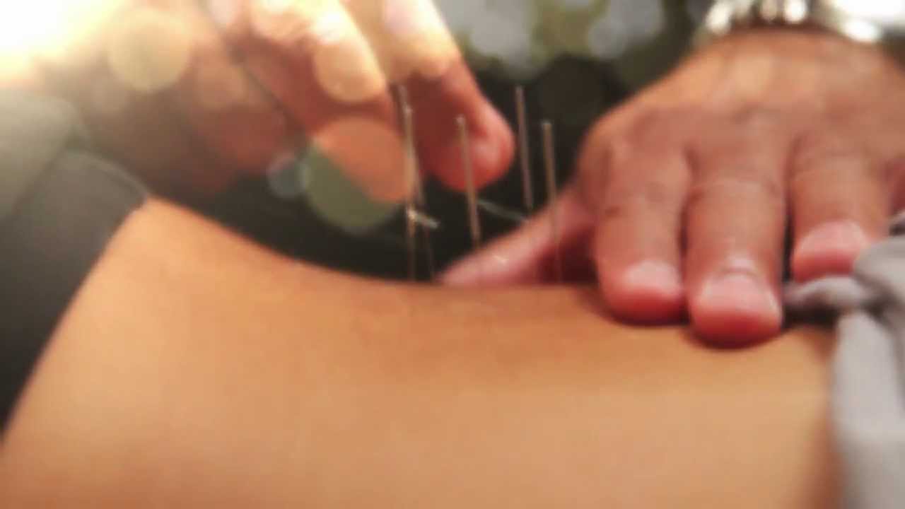 Acupuncture - Advanced PMR Physical Therapy - Belmar, Lake Como, Seagirt, New Jersey