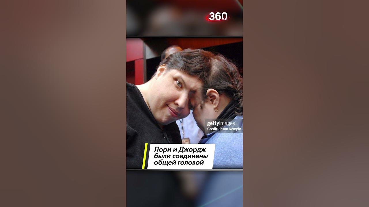 Вместе до конца: умерли старейшие в мире сиамские близнецы - YouTube
