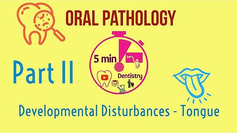 Developmental Disturbances of Tongue - Part 2 - Oral Pathology lectures -5mindentistry