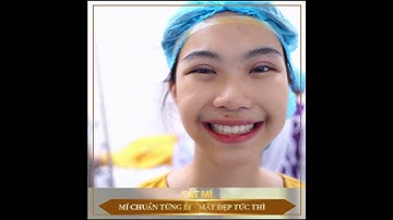 MÃN NHÃN VỚI KẾT QUẢ CẮT MÍ MANI MINI DEEP 5D TẠI DR. HẢI LÊ !