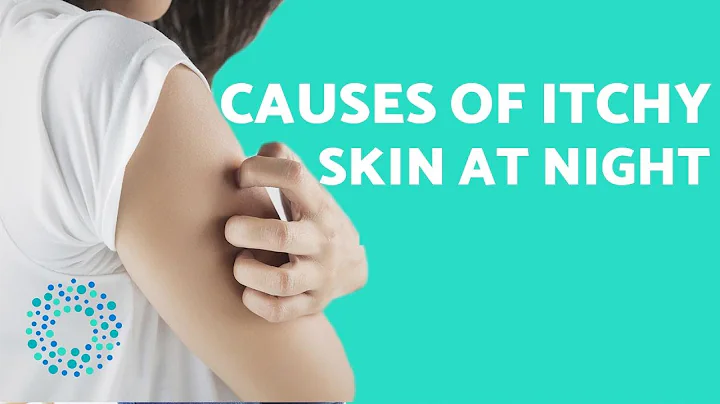 Why does my BODY ITCH at night? - Causes & Solutions of ITCHY SKIN - DayDayNews