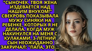 Муж накинулся на меня с кулаками, за то что свекровь, сказала , что синяки у ребенка от меня...
