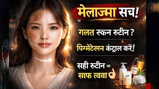 मेलाज़्मा खुद से और गहरा कर रही हैं? ये सच आपको चौंका देगा! screenshot 2