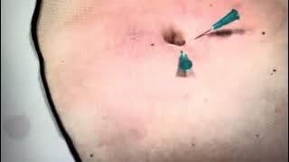 Navel Play Continues #navel #navelpiercing #dailyvlog 