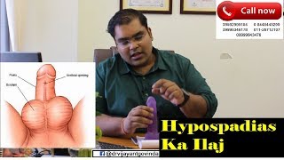 लिंग में पेशाब का छेद गलत जगह है | Hypospadias Complete Guide in Hindi