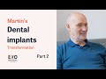 Martin's Smile in a Day Dental Implants Journey - Part 2 - My Life's Now Back to Normal