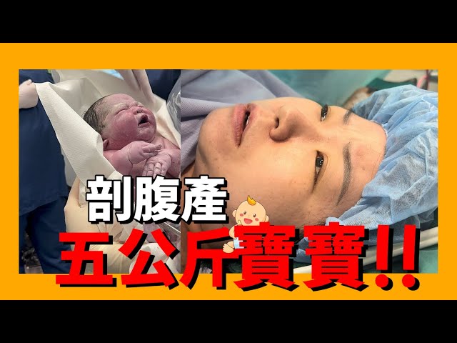 剖腹產五公斤寶寶!!結果麻醉失敗手術被迫停止2次還失血!