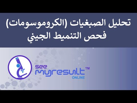 فيديو: ما هو اختبار فحص اختلال الصيغة الصبغية؟