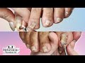 👣Curling Wavy PINCHING TOENAILS How to Clean & Restore - Big Toes Only👣