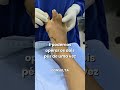 CIRURGIA DE JOANETES NOS PÉS - DEPOIMENTO DE QUEM VIVEU O PROCESSO. #dornospés halux valgo #bunions