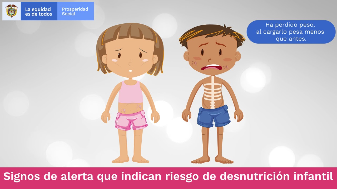 Español - Signos físicos de desnutrición infantil - thptnganamst.edu.vn