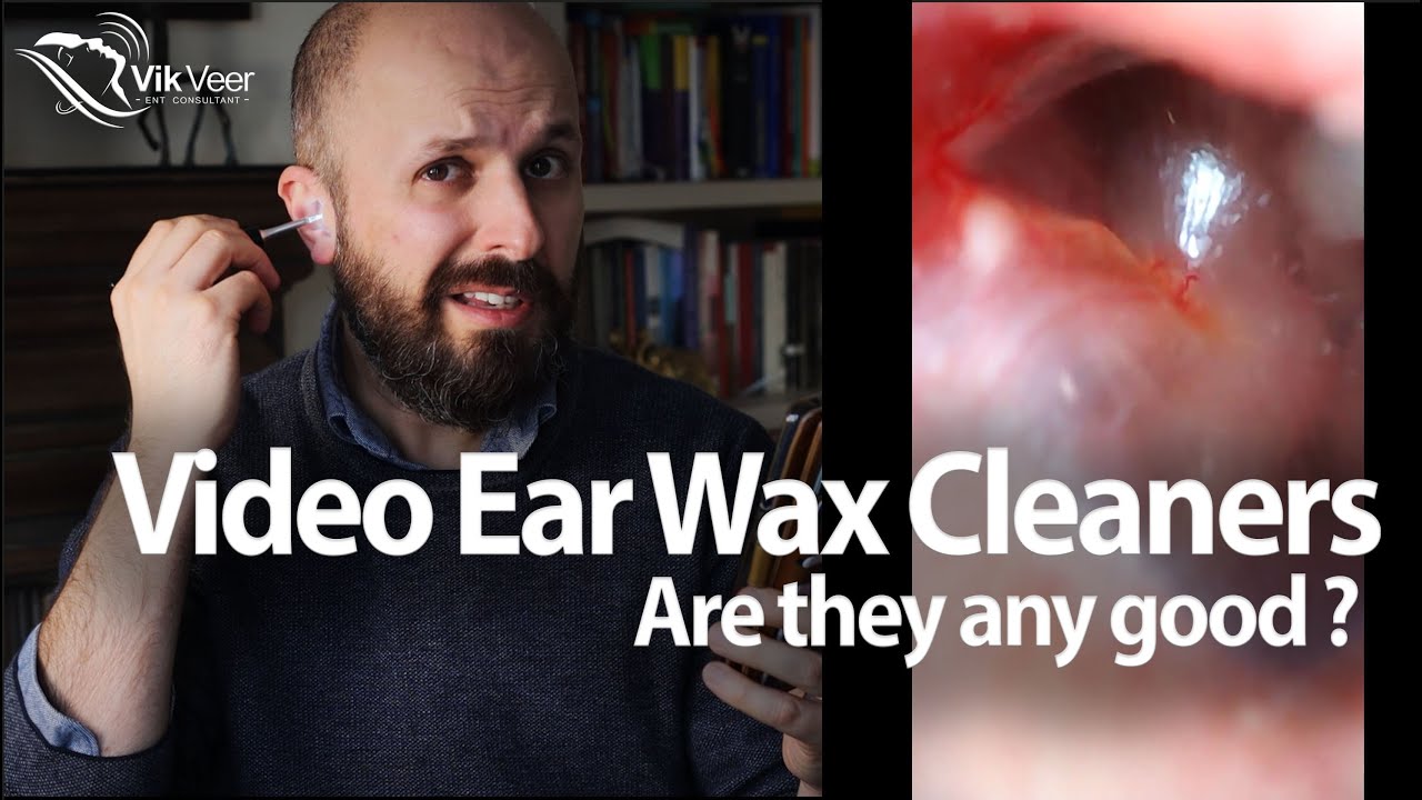 Ear Surgeon Reviews Home Ear Wax Removal Cameras 