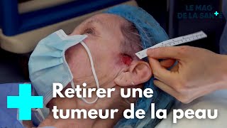 Les prouesses de la chirurgie réparatrice 5/5 - Le Magazine de la Santé