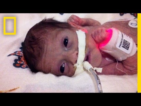 Video: När kan ett barn födas tidigt och överleva?