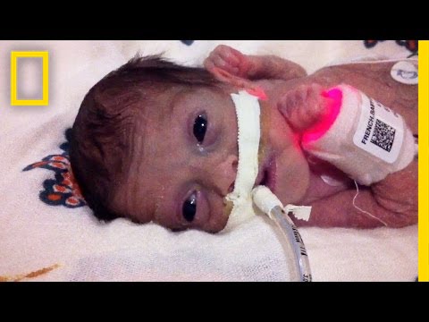 5 month premature baby