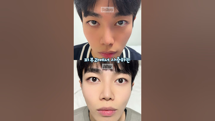 와 이게 진짜라고? 미백효과 좋다고 난리난 미백크림을 실제로 리뷰해봤습니다 #kbeauty #후기 #미백 #미백크림