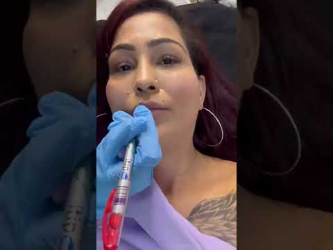 Natural lip blushing results after one time ๐โ๏ธ8826774495