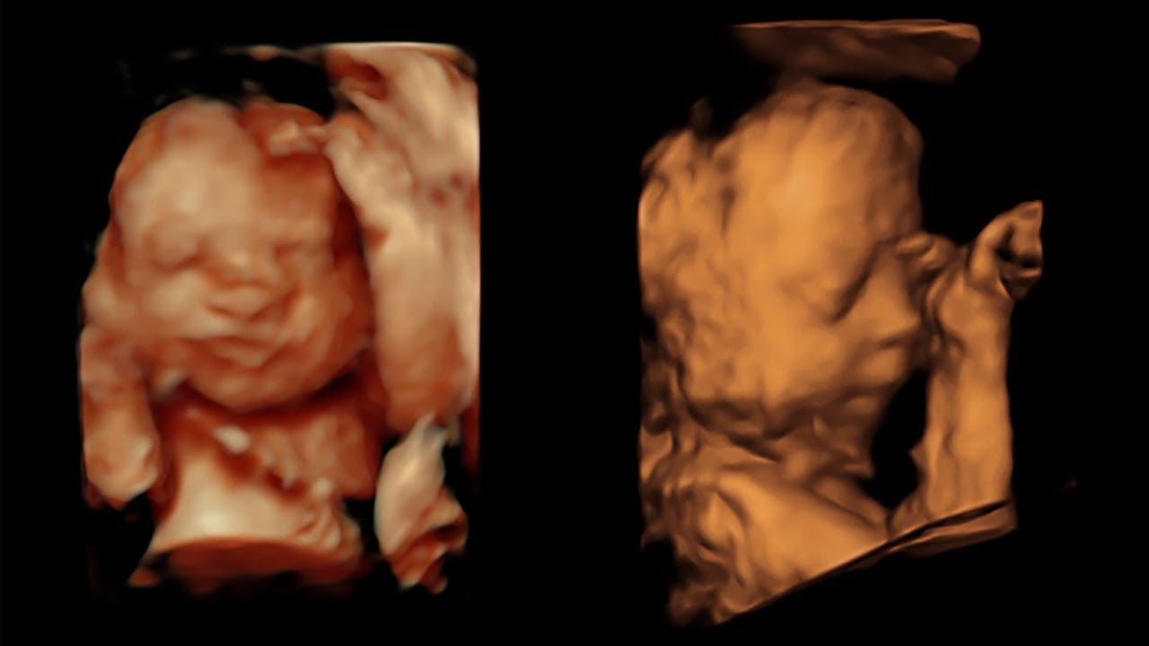 3d 4d Ultrasound At 28 Weeks Youtube 