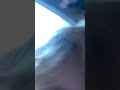 I’m going to video YOU. Loopy son after wisdom teeth surgery.