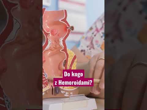 Wideo: Jak stwierdzić, czy masz hemoroidy wewnętrzne: 9 kroków