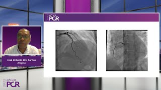 How should I treat a STEMI - A patient's journey - With Angola & Sudan - Webinar