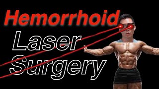 Laser Hemorrhoid Surgery | Dr Chungs POV