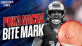 New Puka Nacua Bite Mark Photo