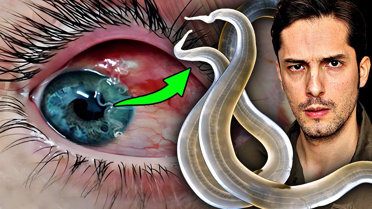 Kleine Würmer Vor Den Augen