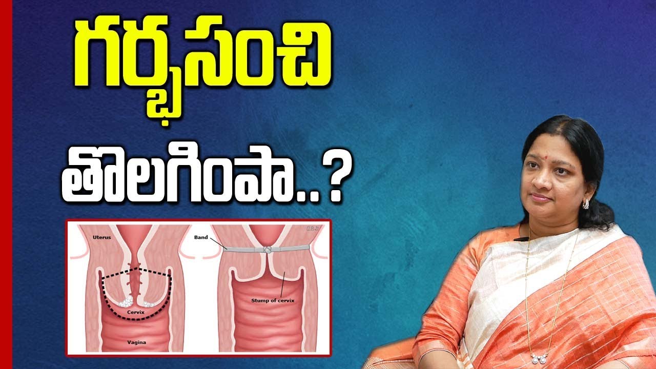 Vaginal Hysterectomy Uterine Fibroids | Removal of Uterus from Woman! | Movva Madhuri | SumanTV Mom