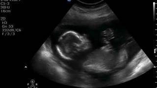 12-01-06-185217_ORTIZ_20120106_200829_0017.AVI
