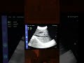 Demo F5 USB Convex Wireless ultrasound probe Can attach Mobile Best price 00923214447817 By Sonotech