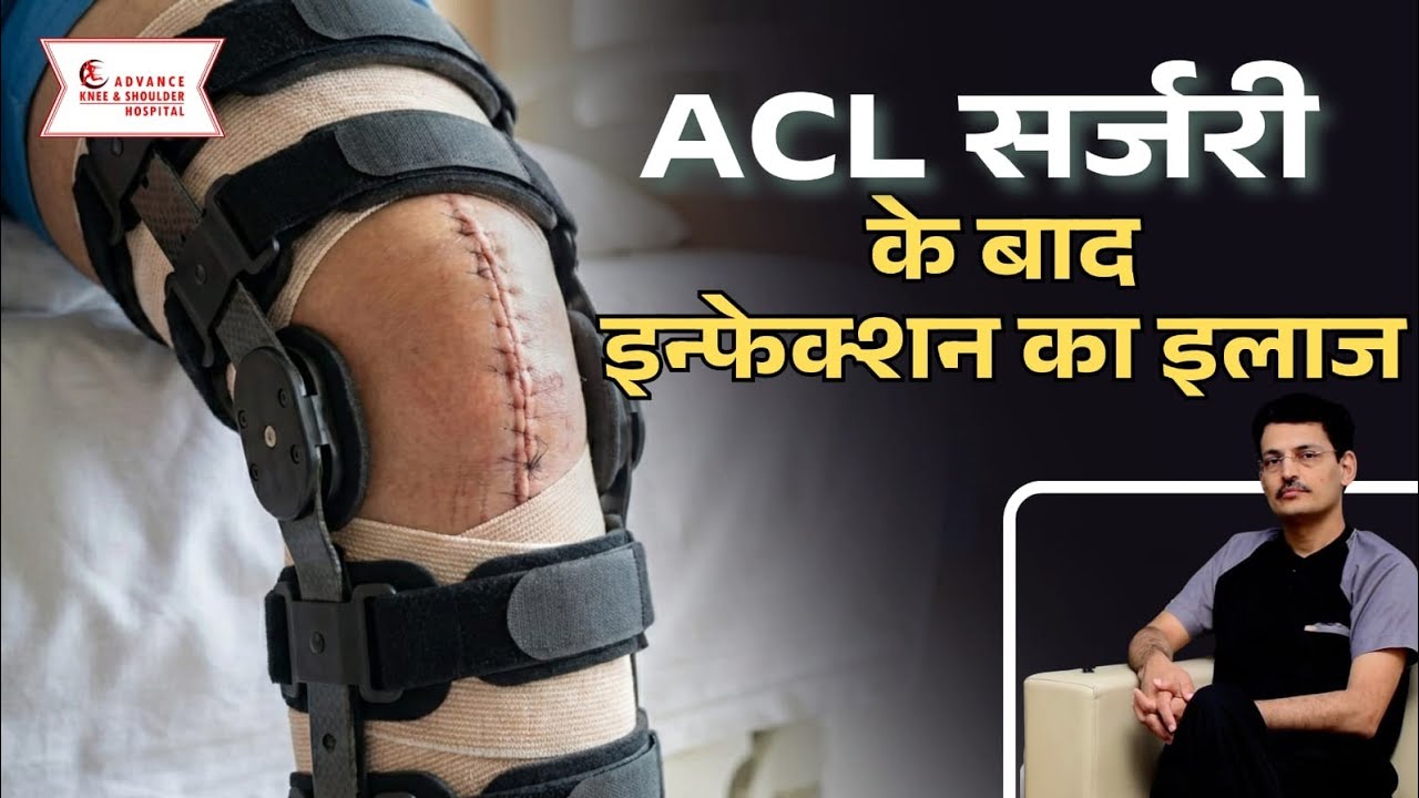 Infection after acl surgery 