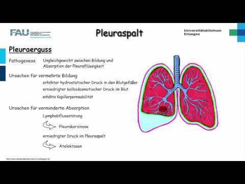 Video: Wie kann man sich an Transsudat und Exsudat erinnern?