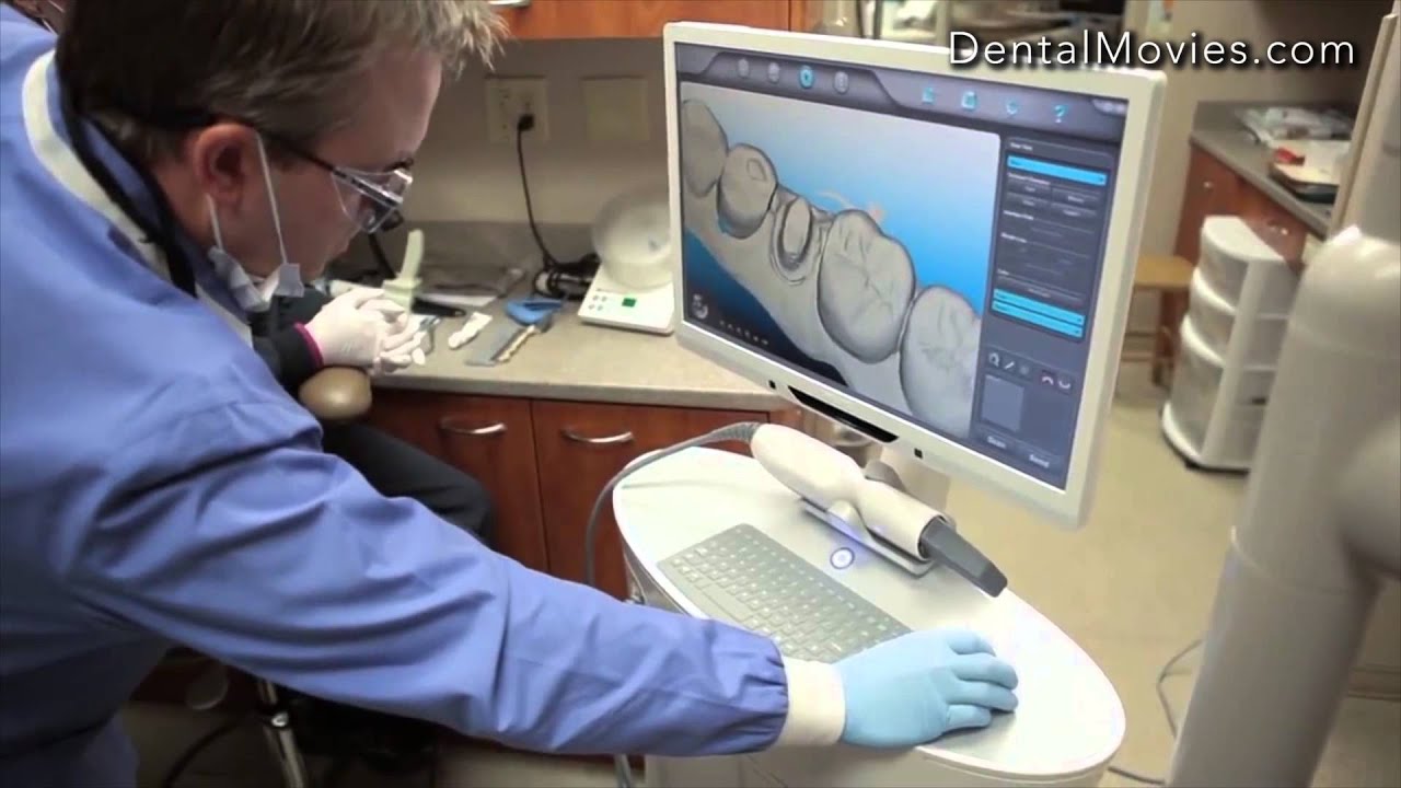 iTero - Restorative Scanning