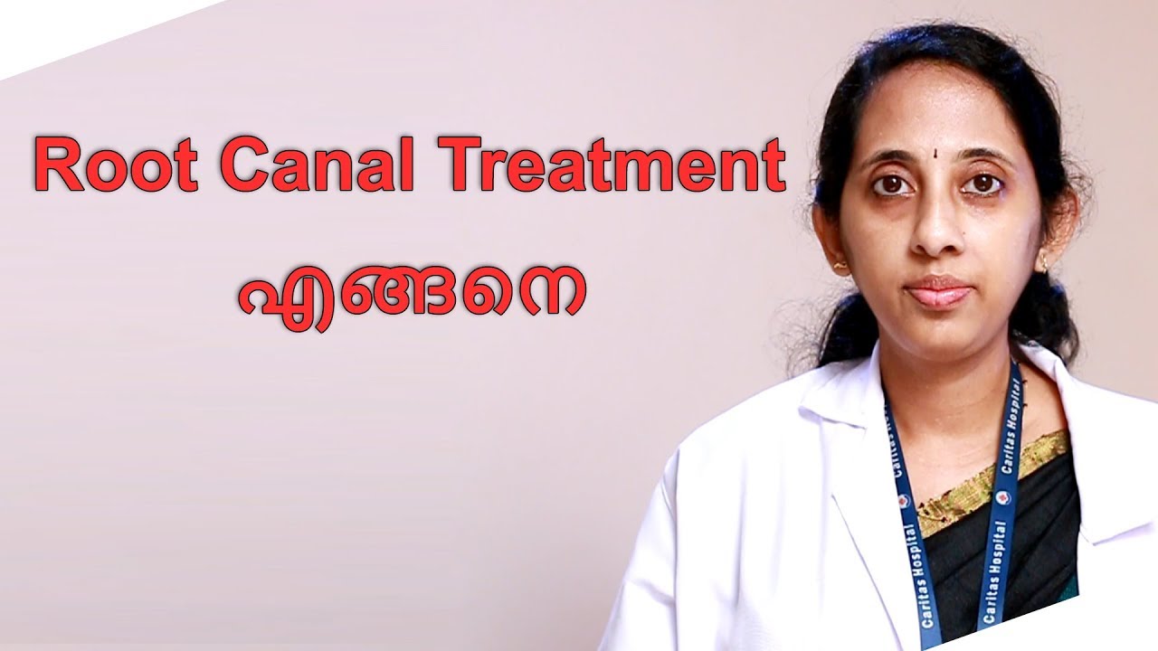 Root Canal Treatment എങ്ങനെ??? LATEST MALAYALAM HEALTH TIPS YouTube