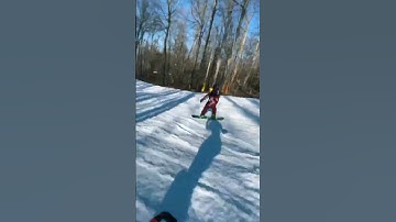 PeterVigilante - My collarbone healed out of place and still looks like the last part of the video