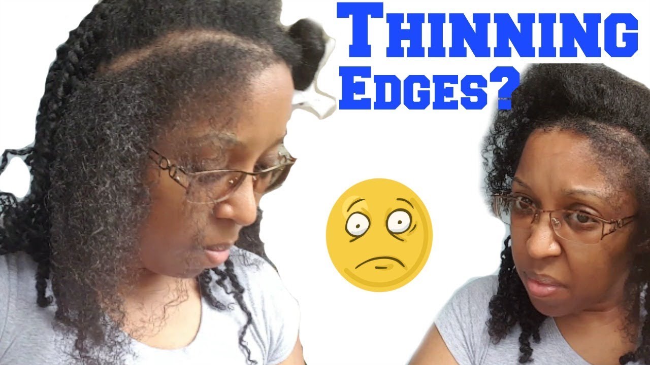 How To Hairstyle For Thinning Edges Double Twist With Bantu Knot
