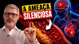 HOMOCISTEÍNA ALTA e o risco de infarto: o que fazer?